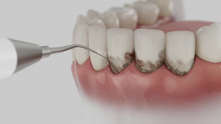 Reliable Wisdom Tooth Removal contractor in Overton County County, TN by Dentist Open Now